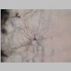 Neuronas Golgi 24.jpg